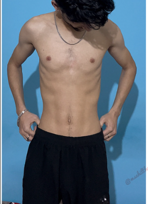 Ayush before